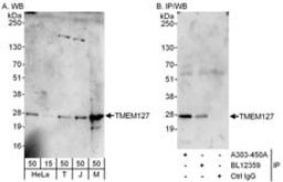 Detection of human and mouse TMEM127 by western blot (h and m) and immunoprecipitation (h).