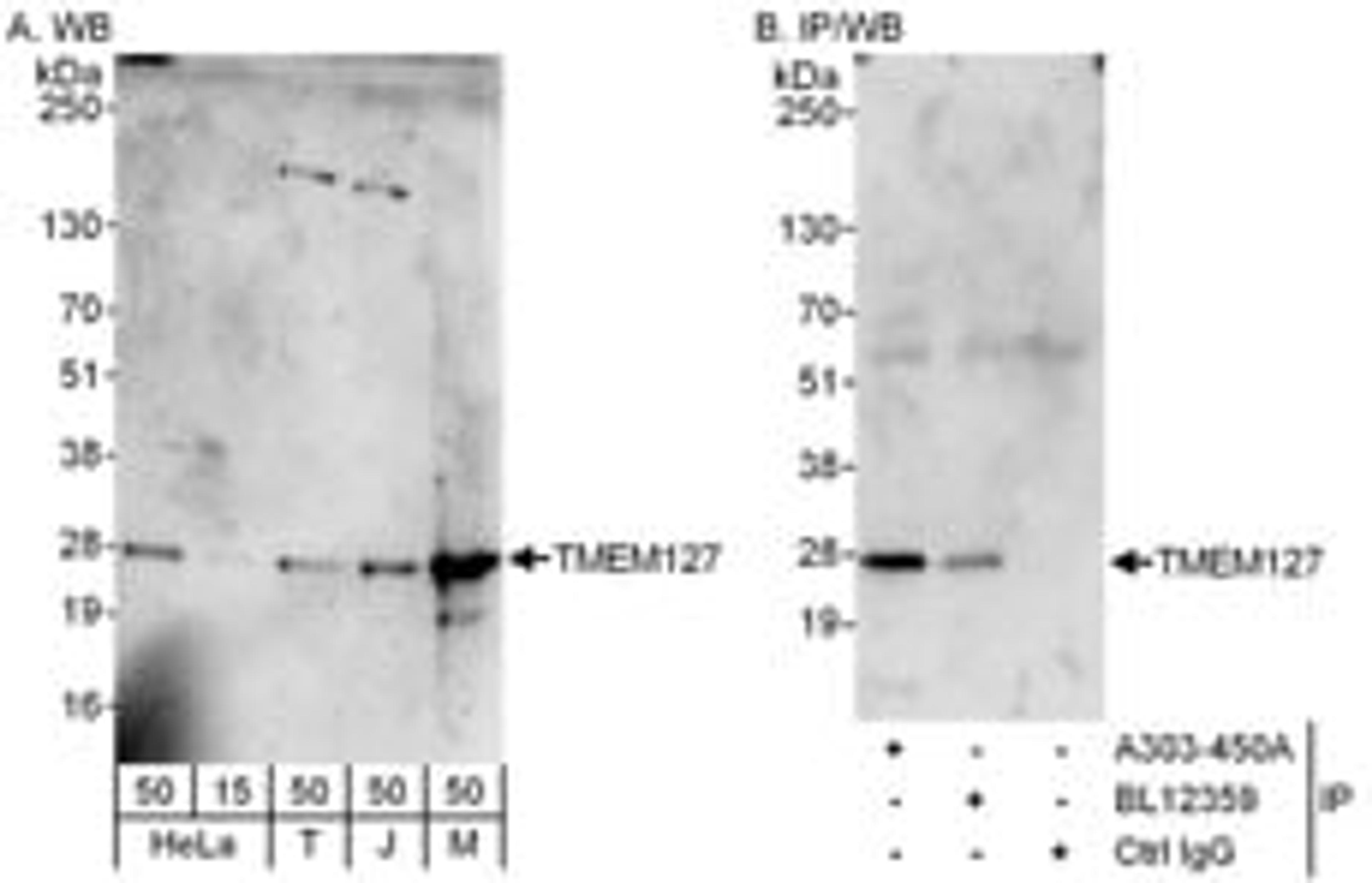 Detection of human and mouse TMEM127 by western blot (h and m) and immunoprecipitation (h).