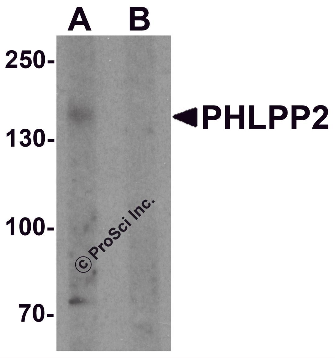 Western blot analysis of PHLPP2 in SW480 cell lysate with PHLPP2 antibody at 1 μg/ml in (A) the presence and (B) the absence of blocking peptide.