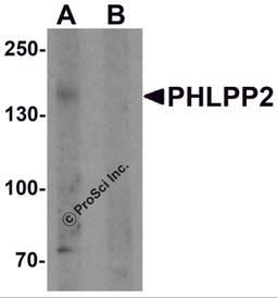 Western blot analysis of PHLPP2 in SW480 cell lysate with PHLPP2 antibody at 1 μg/ml in (A) the presence and (B) the absence of blocking peptide.