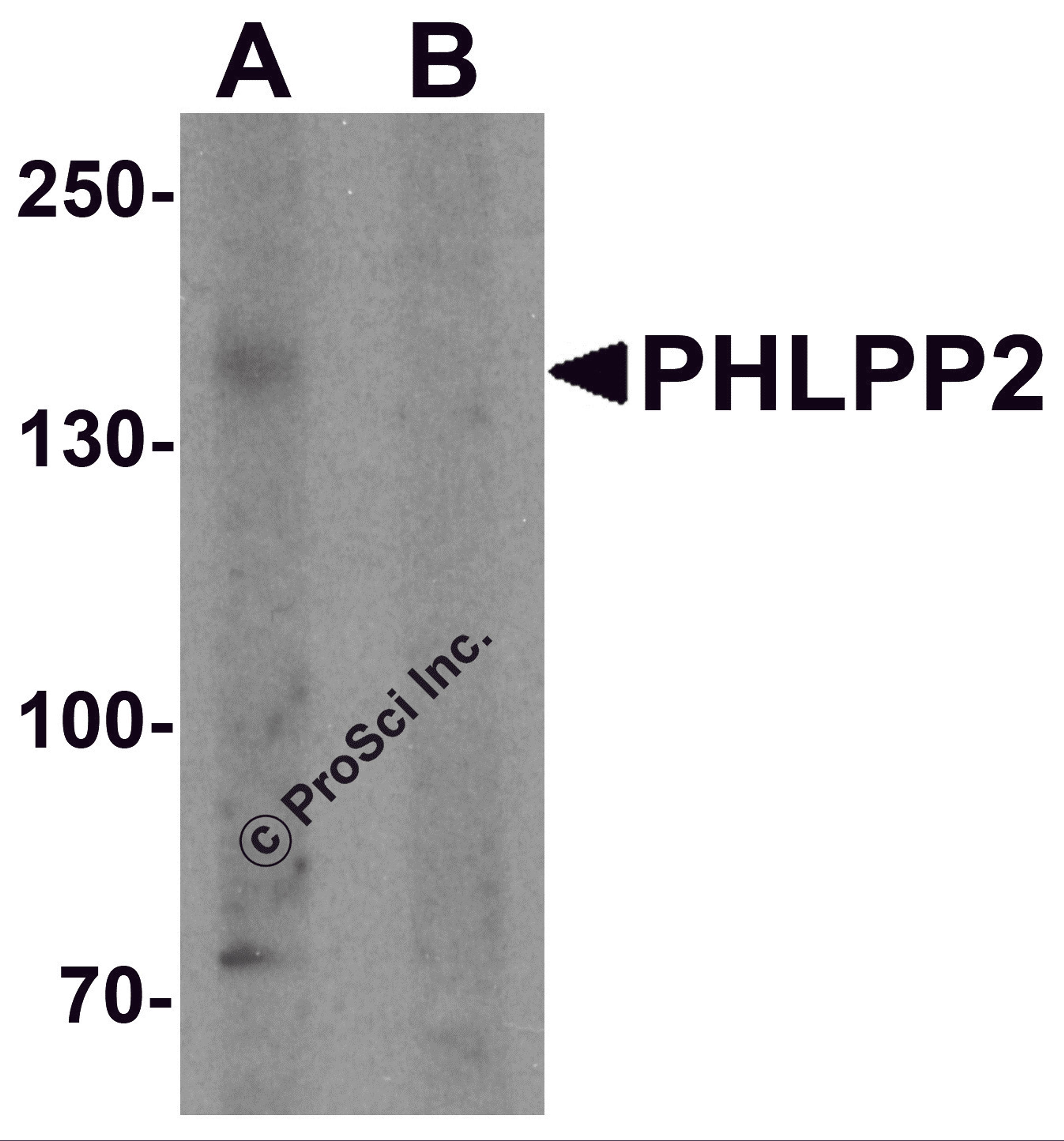 Western blot analysis of PHLPP2 in SW480 cell lysate with PHLPP2 antibody at 1 μg/ml in (A) the presence and (B) the absence of blocking peptide.