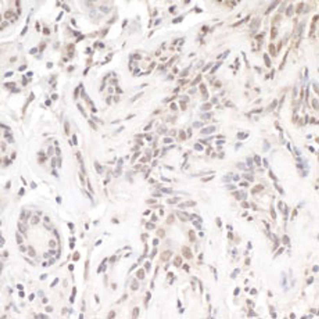 Detection of human TReP-132/TRERF1 by immunohistochemistry.