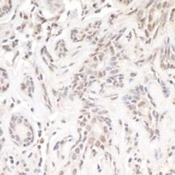 Detection of human TReP-132/TRERF1 by immunohistochemistry.