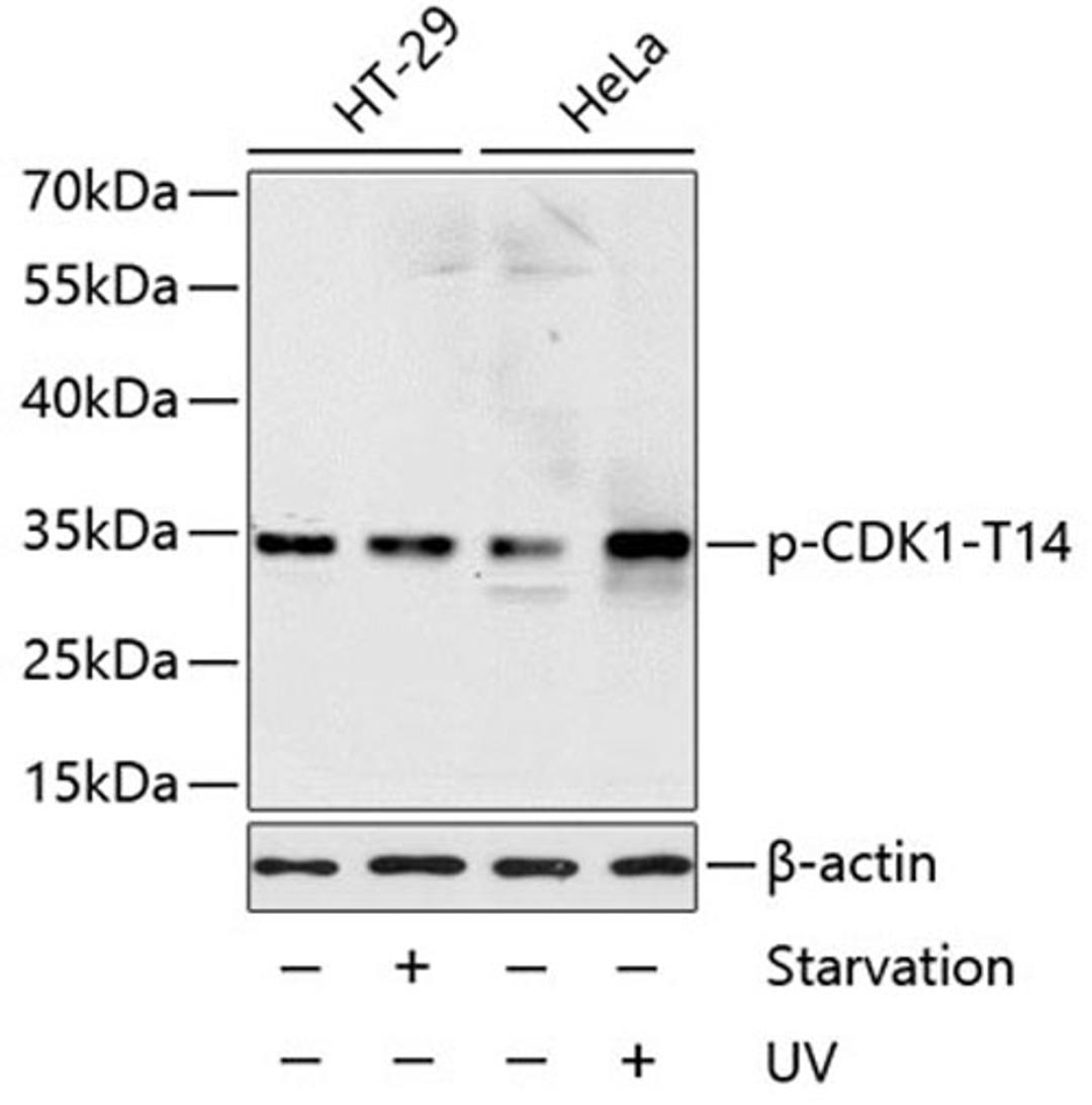 Western blot - Phospho-CDK1-T14 antibody (AP0015)