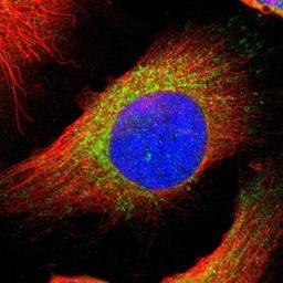 Immunocytochemistry/Immunofluorescence: NSDHL Antibody [NBP1-83306] - Staining of human cell line U-251MG shows positivity in endoplasmic reticulum & vesicles.