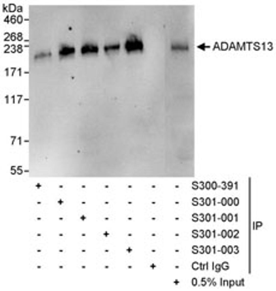 Detection of human ADAMTS13 by western blot and immunoprecipitation.