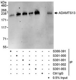 Detection of human ADAMTS13 by western blot and immunoprecipitation.