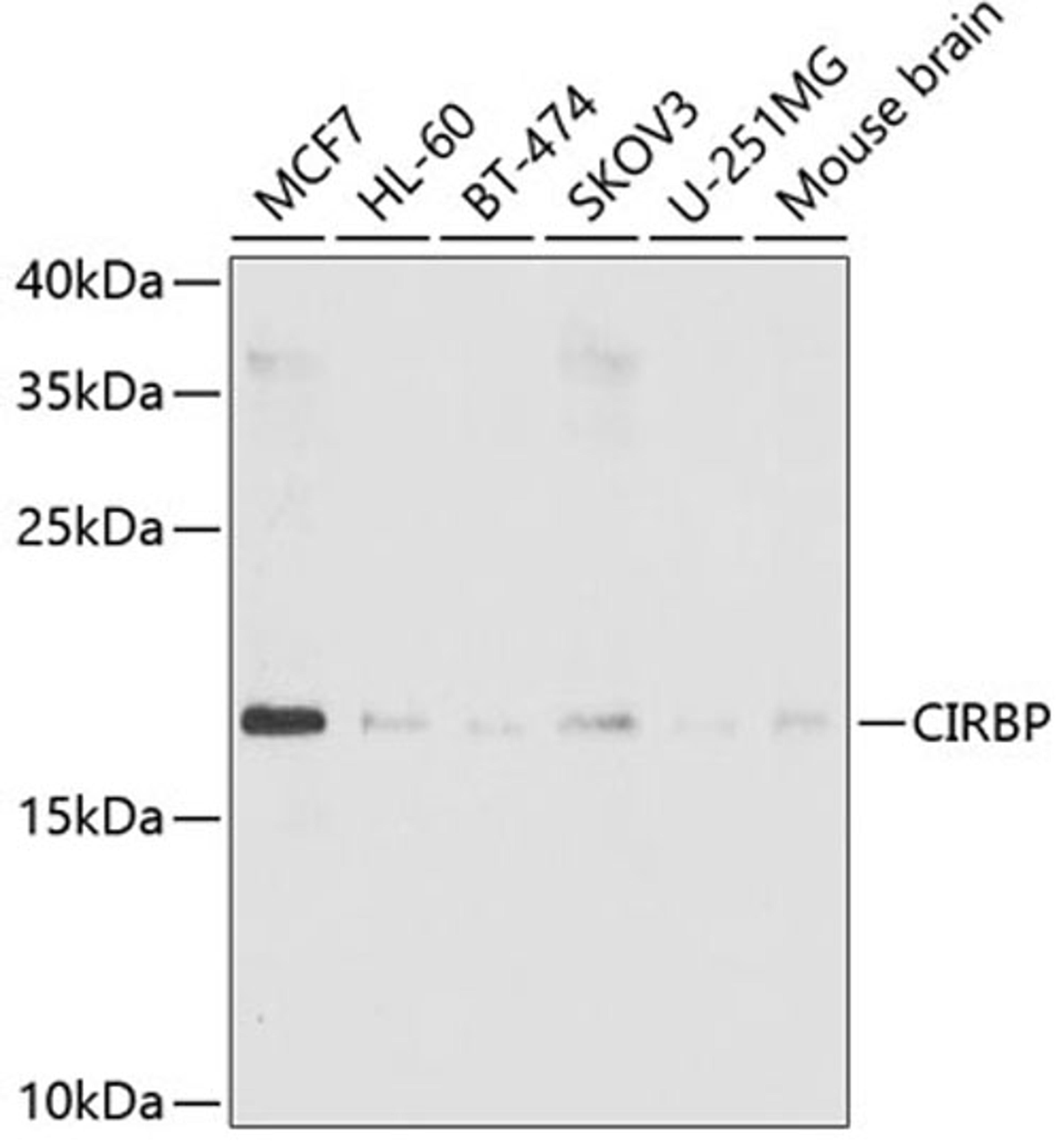 Western blot - CIRBP antibody (A6559)