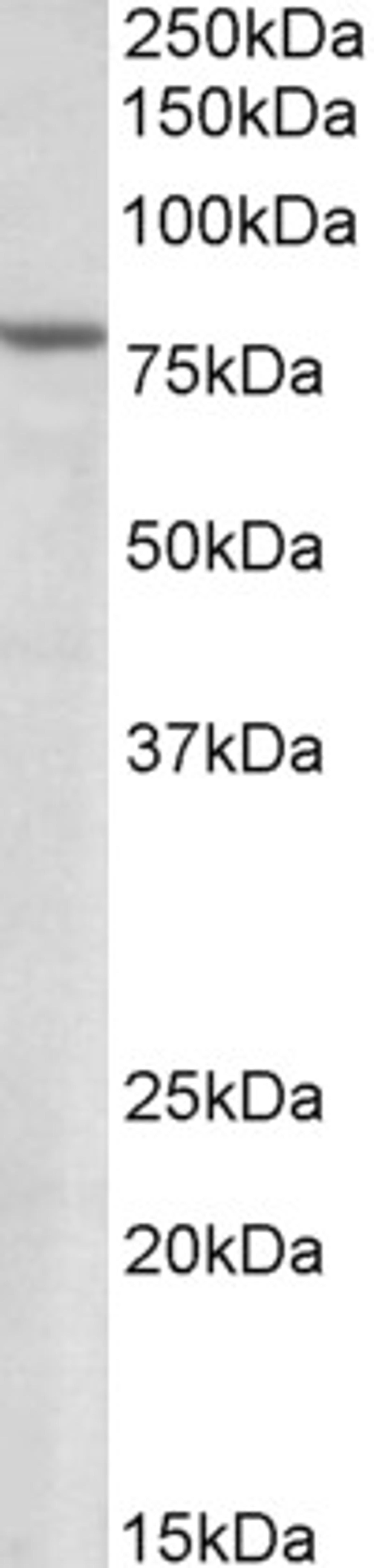 46-361 (1.5ug/ml) staining of Human Heart lysate (35ug protein in RIPA buffer). Primary incubation was 1 hour. Detected by chemiluminescence.