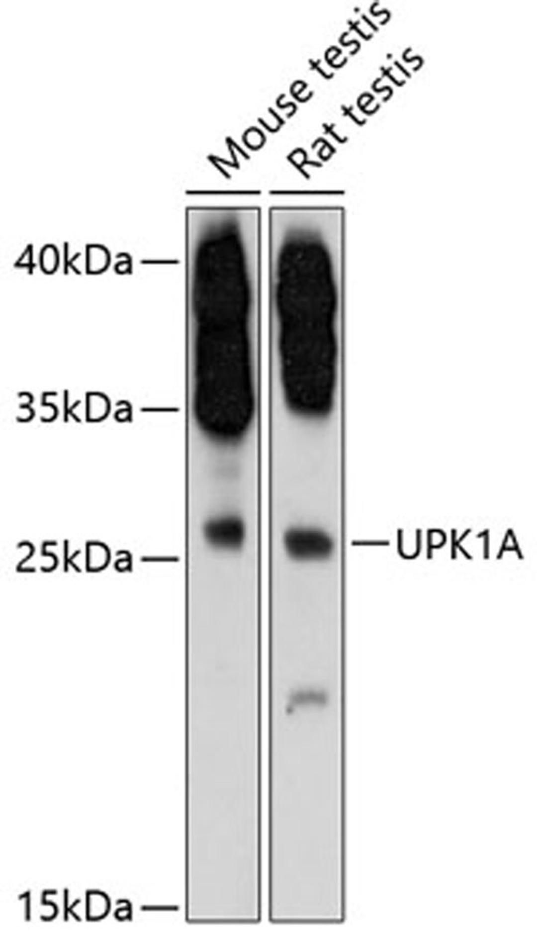 Western blot - UPK1A antibody (A12761)