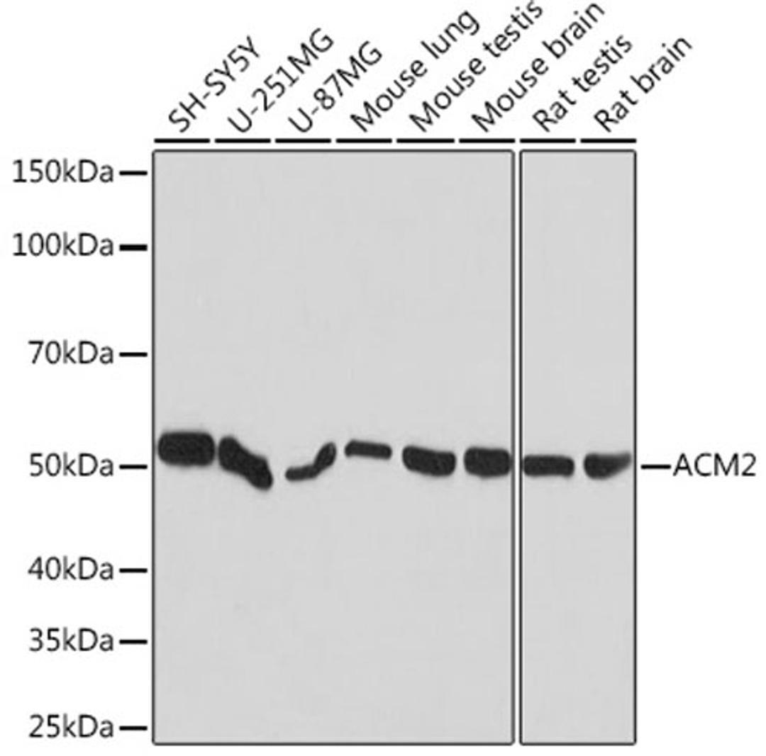 Western blot - ACM2 Rabbit mAb (A5154)