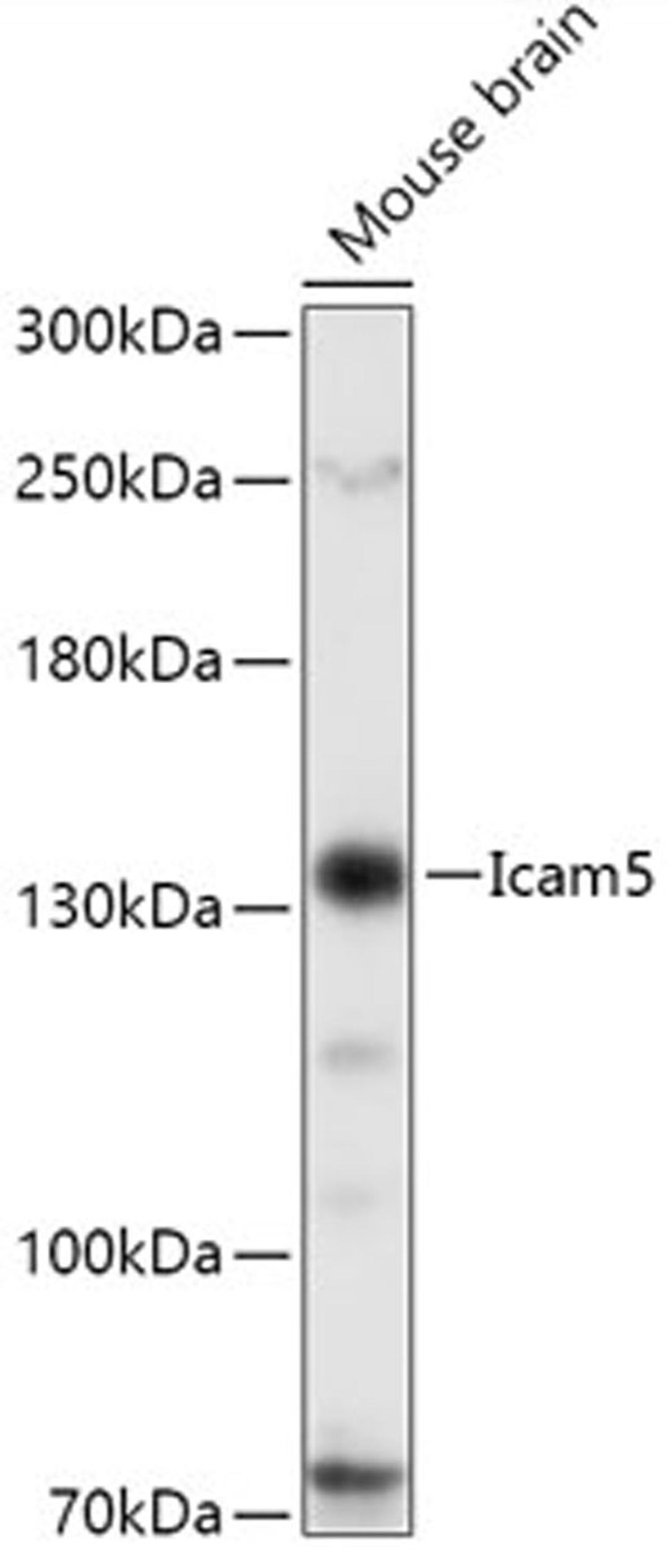 Western blot - Icam5 antibody (A15732)