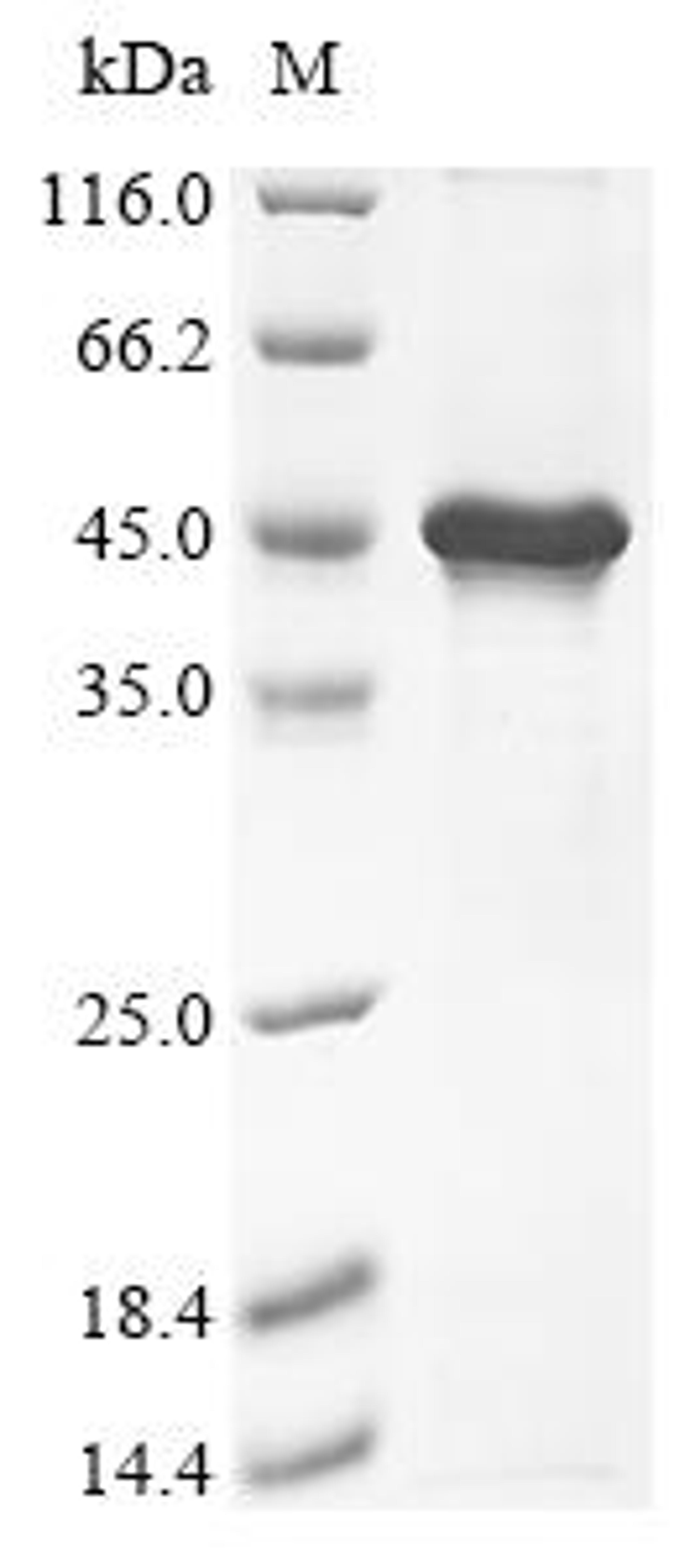 (Tris-Glycine gel) Discontinuous SDS-PAGE (reduced) with 5% enrichment gel and 15% separation gel.