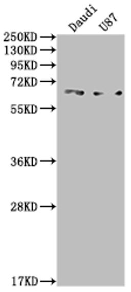 Western Blot. Positive WB detected in: Daudi whole cell lysate, U87 whole cell lysate. All lanes: ACVRL1 antibody at 1:2000. Secondary. Goat polyclonal to rabbit IgG at 1/50000 dilution. Predicted band size: 57 kDa. Observed band size: 65 kDa. 