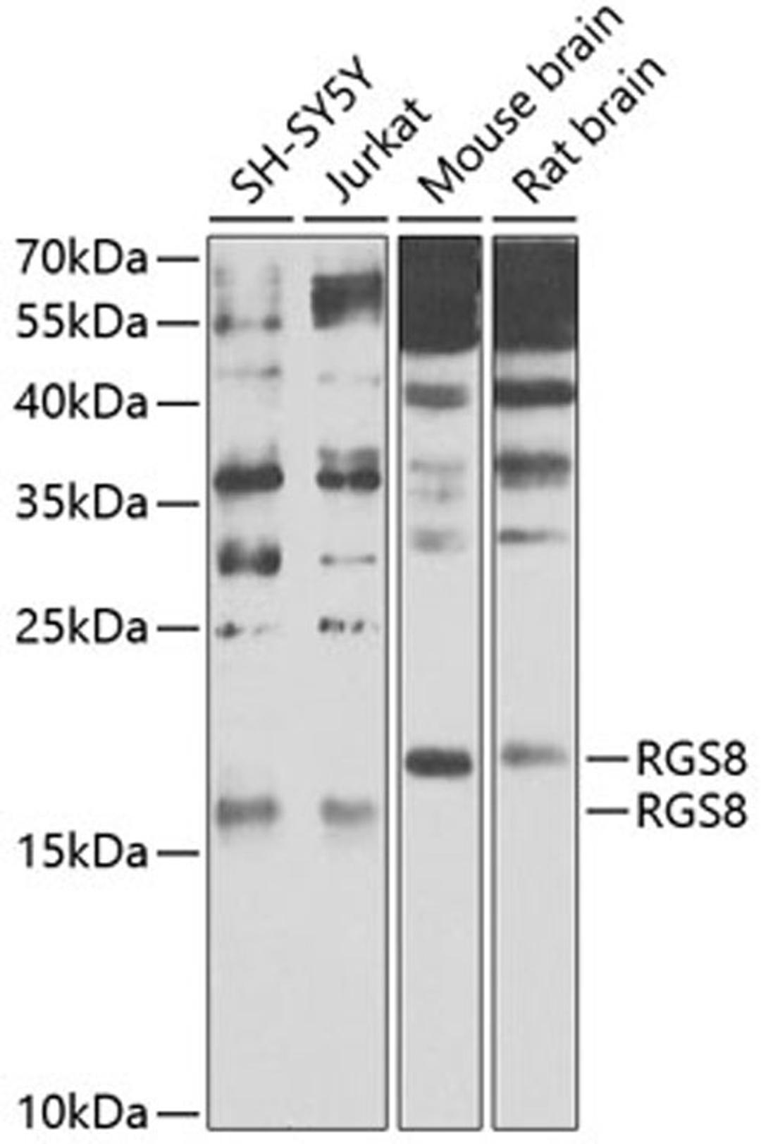 Western blot - RGS8 antibody (A9987)