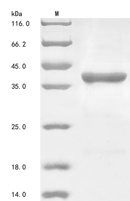 (Tris-Glycine gel) Discontinuous SDS-PAGE (reduced) with 5% enrichment gel and 15% separation gel.