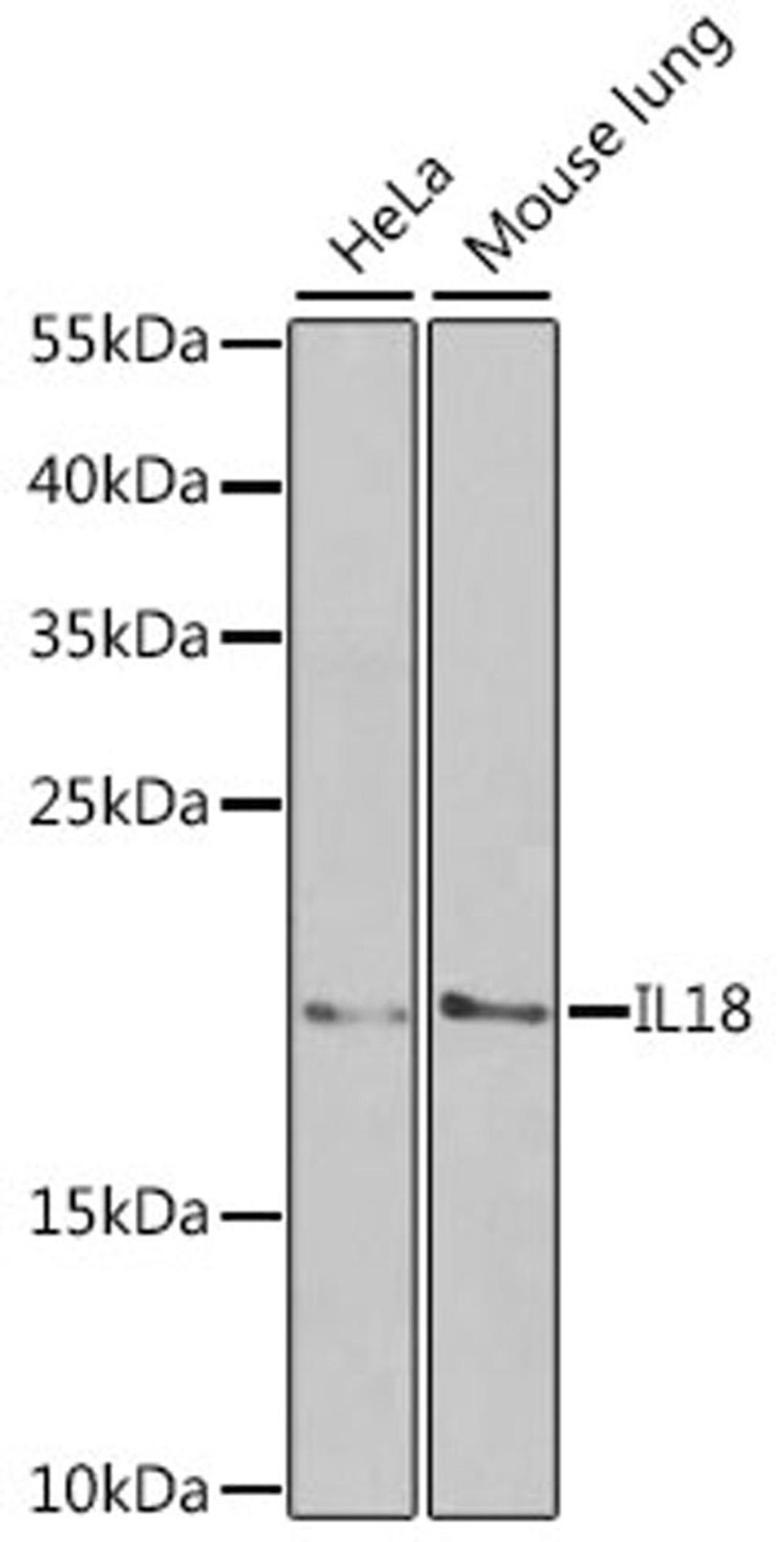 Western blot - IL18 antibody (A1115)