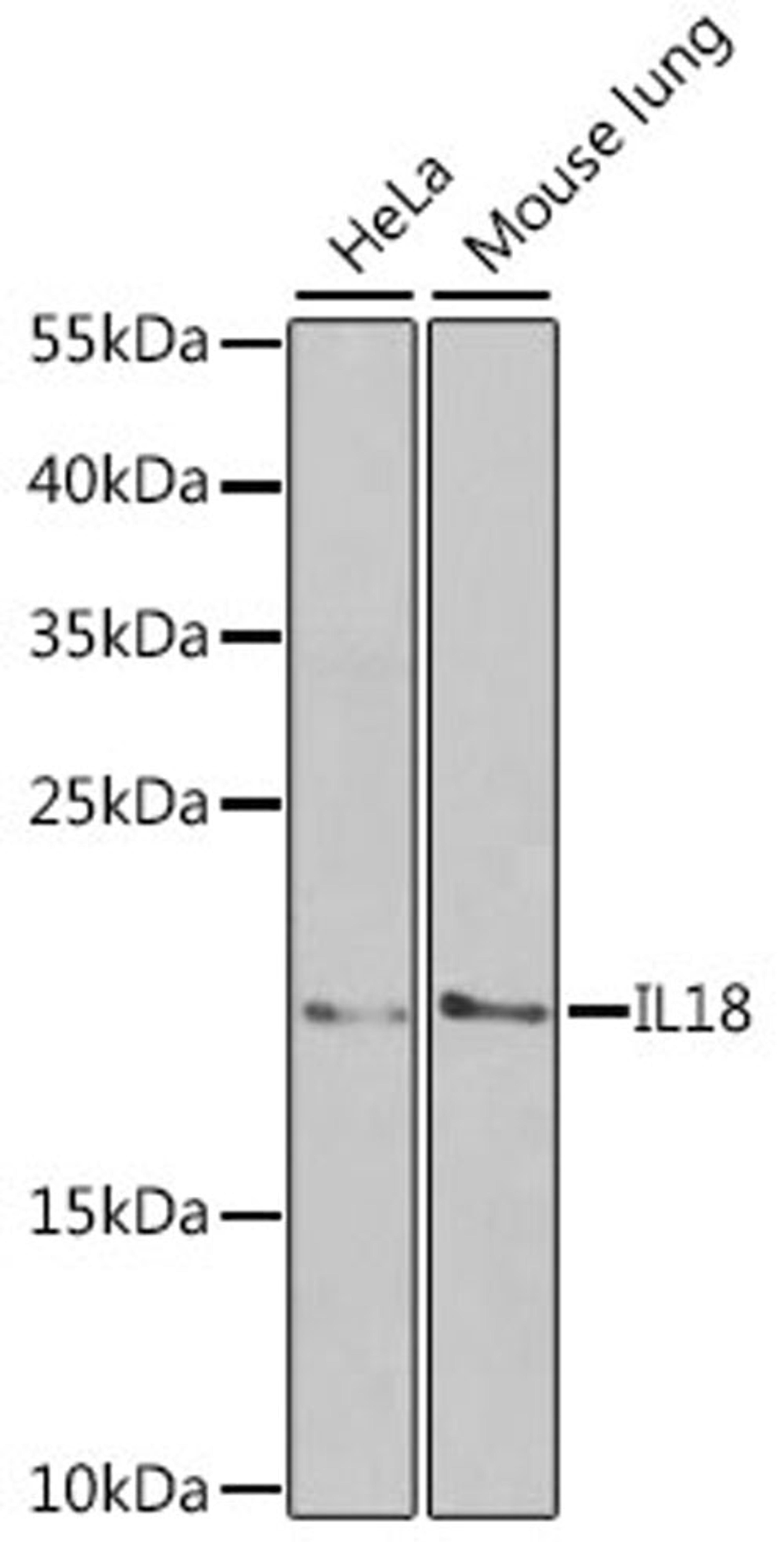 Western blot - IL18 antibody (A1115)