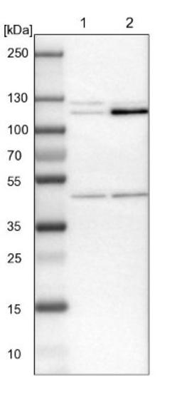 Immunohistochemistry-Paraffin: HKDC1 Antibody [NBP1-82108] - Lane 1: NIH-3T3 cell lysate (Mouse embryonic fibroblast cells)<br/>Lane 2: NBT-II cell lysate (Rat Wistar bladder tumour cells)