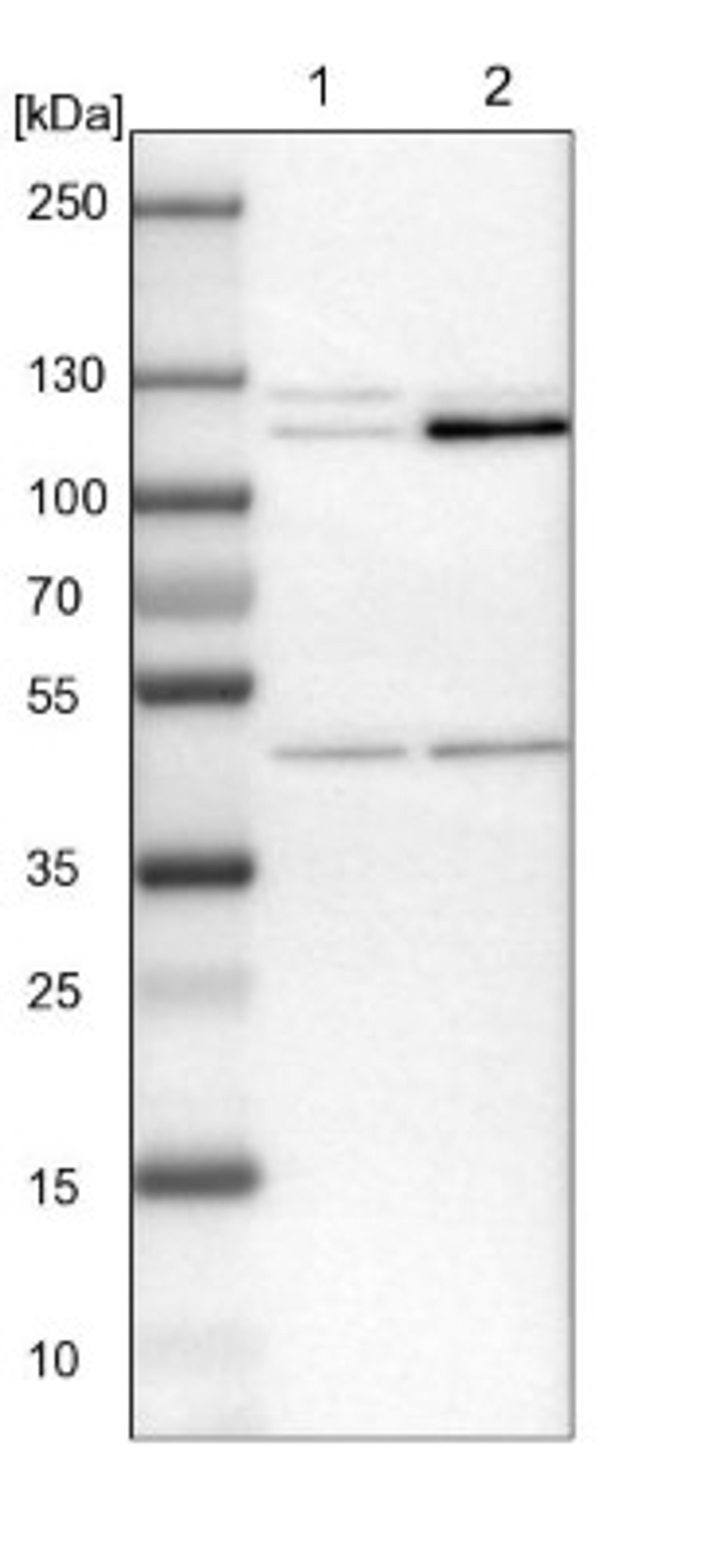 Immunohistochemistry-Paraffin: HKDC1 Antibody [NBP1-82108] - Lane 1: NIH-3T3 cell lysate (Mouse embryonic fibroblast cells)<br/>Lane 2: NBT-II cell lysate (Rat Wistar bladder tumour cells)