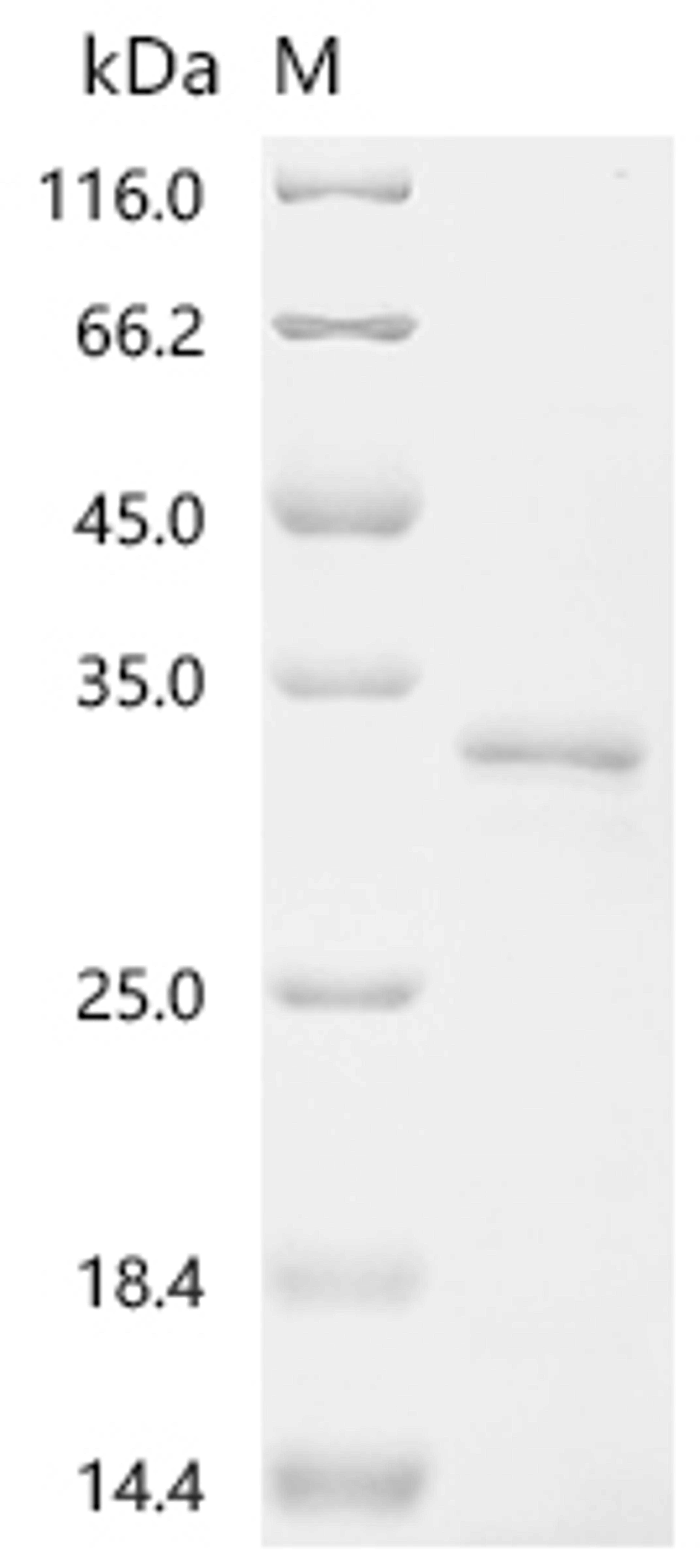 (Tris-Glycine gel) Discontinuous SDS-PAGE (reduced) with 5% enrichment gel and 15% separation gel.