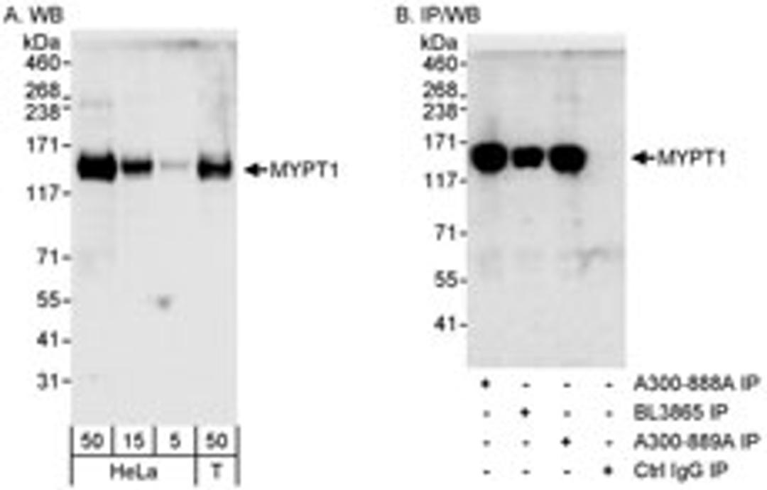 Detection of human MYPT1 by western blot and immunoprecipitation.