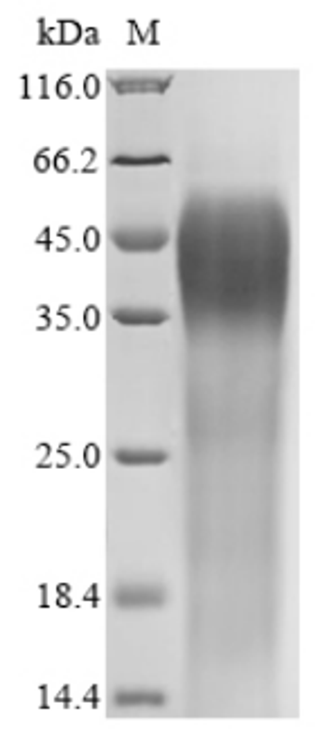 (Tris-Glycine gel) Discontinuous SDS-PAGE (reduced) with 5% enrichment gel and 15% separation gel.