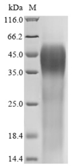 (Tris-Glycine gel) Discontinuous SDS-PAGE (reduced) with 5% enrichment gel and 15% separation gel.