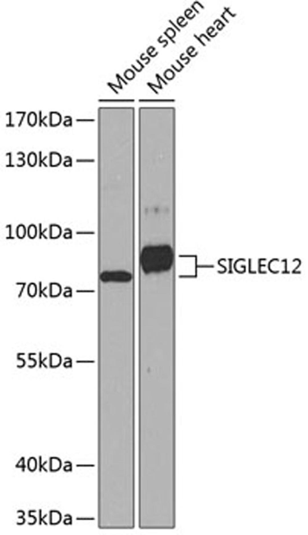 Western blot - SIGLEC12 antibody (A8519)