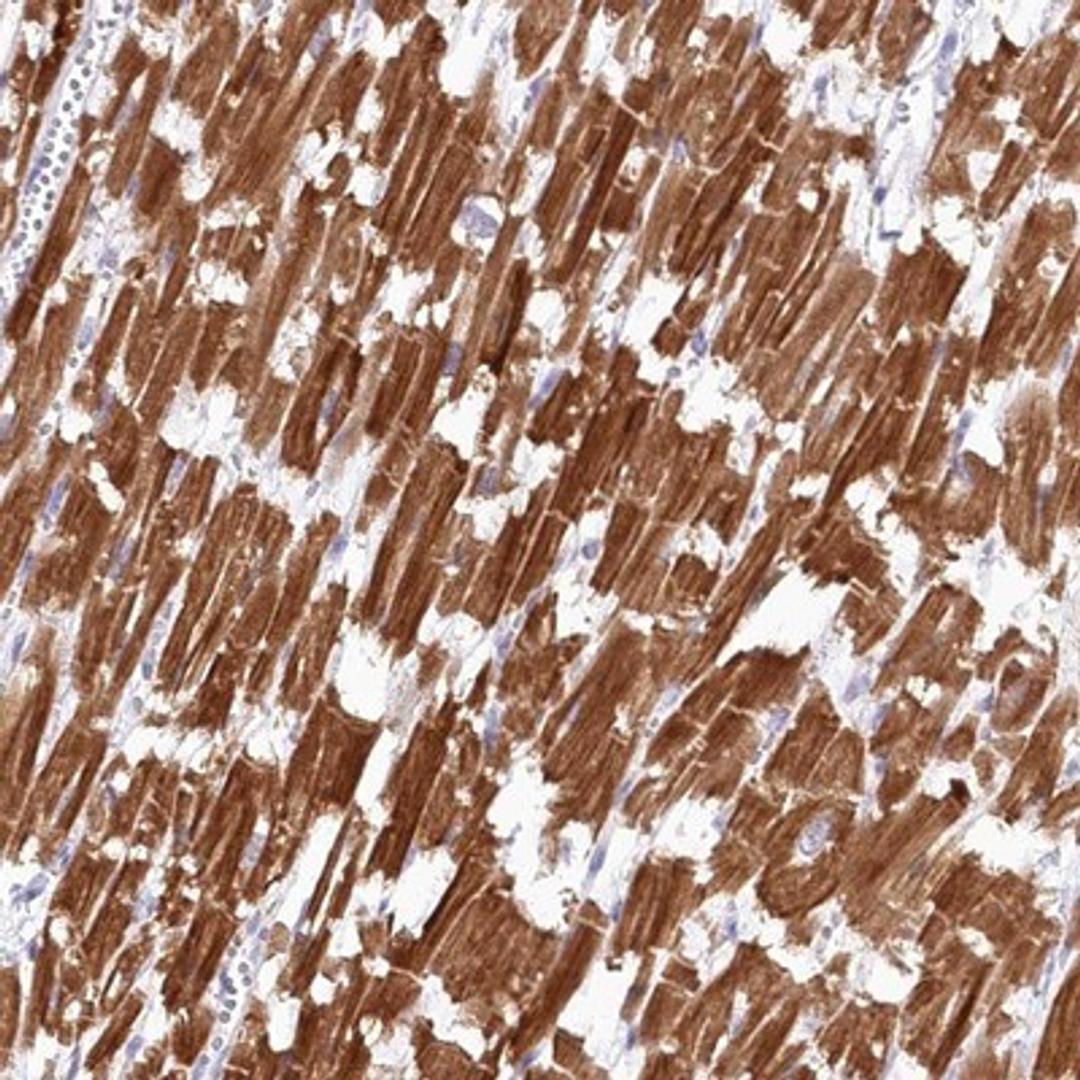 Immunohistochemistry-Paraffin: SNED1 Antibody [NBP1-92415] - Staining of human heart muscle shows strong cytoplasmic positivity in myocytes.