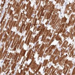 Immunohistochemistry-Paraffin: SNED1 Antibody [NBP1-92415] - Staining of human heart muscle shows strong cytoplasmic positivity in myocytes.