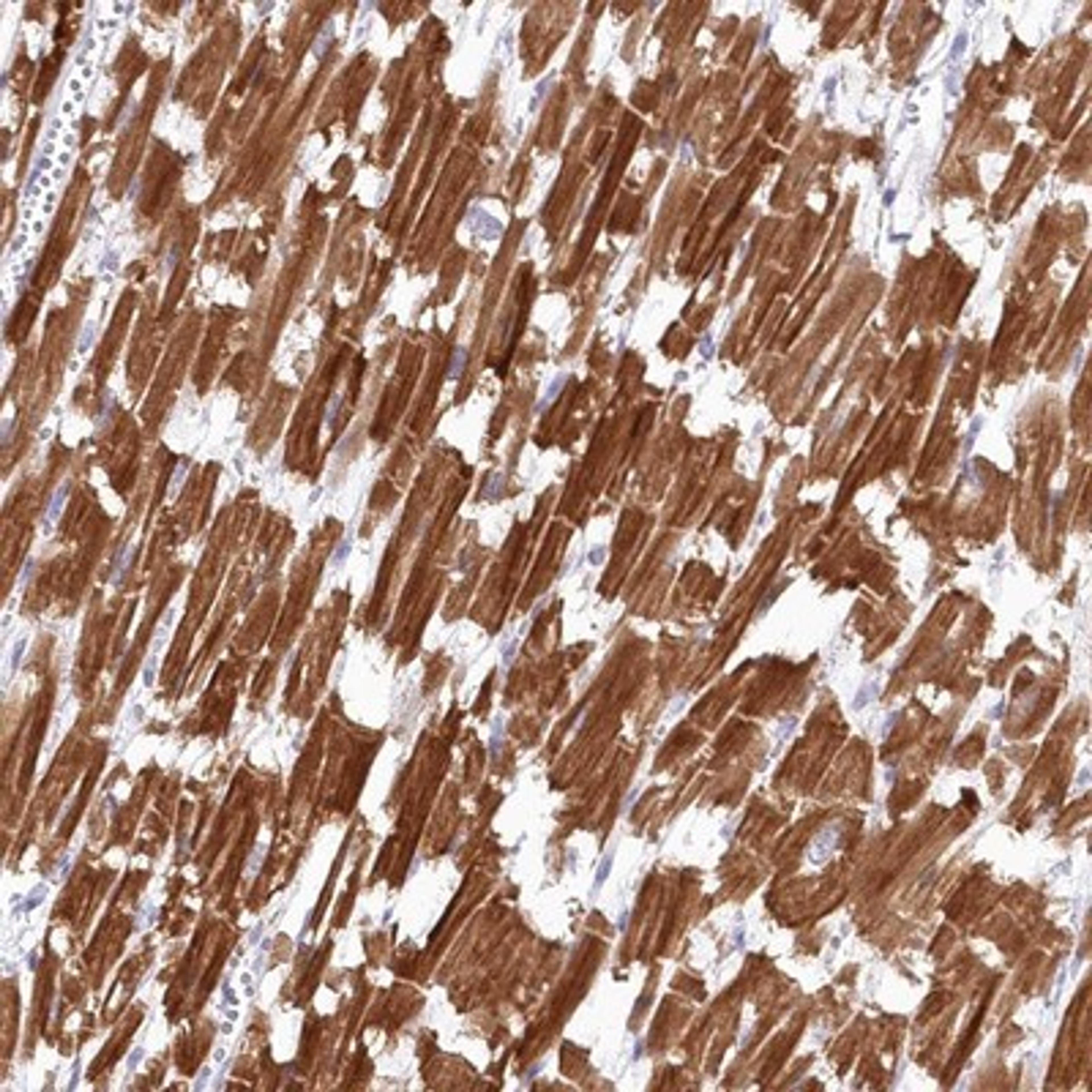 Immunohistochemistry-Paraffin: SNED1 Antibody [NBP1-92415] - Staining of human heart muscle shows strong cytoplasmic positivity in myocytes.