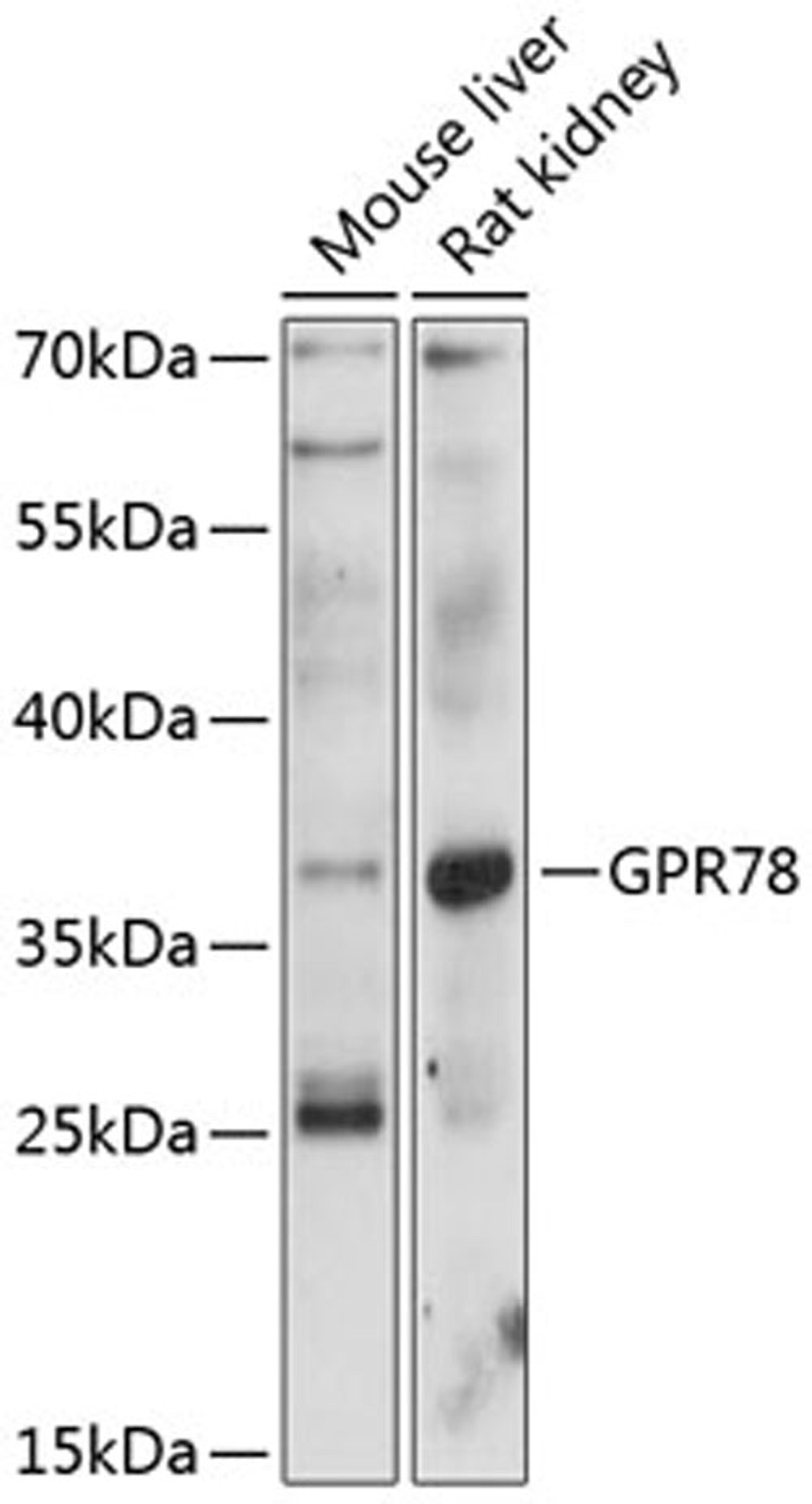 Western blot - GPR78 antibody (A12364)