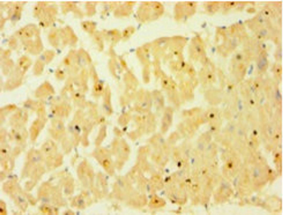 Immunohistochemistry of paraffin-embedded human heart tissue using CSB-PA05824A0Rb at dilution of 1:100