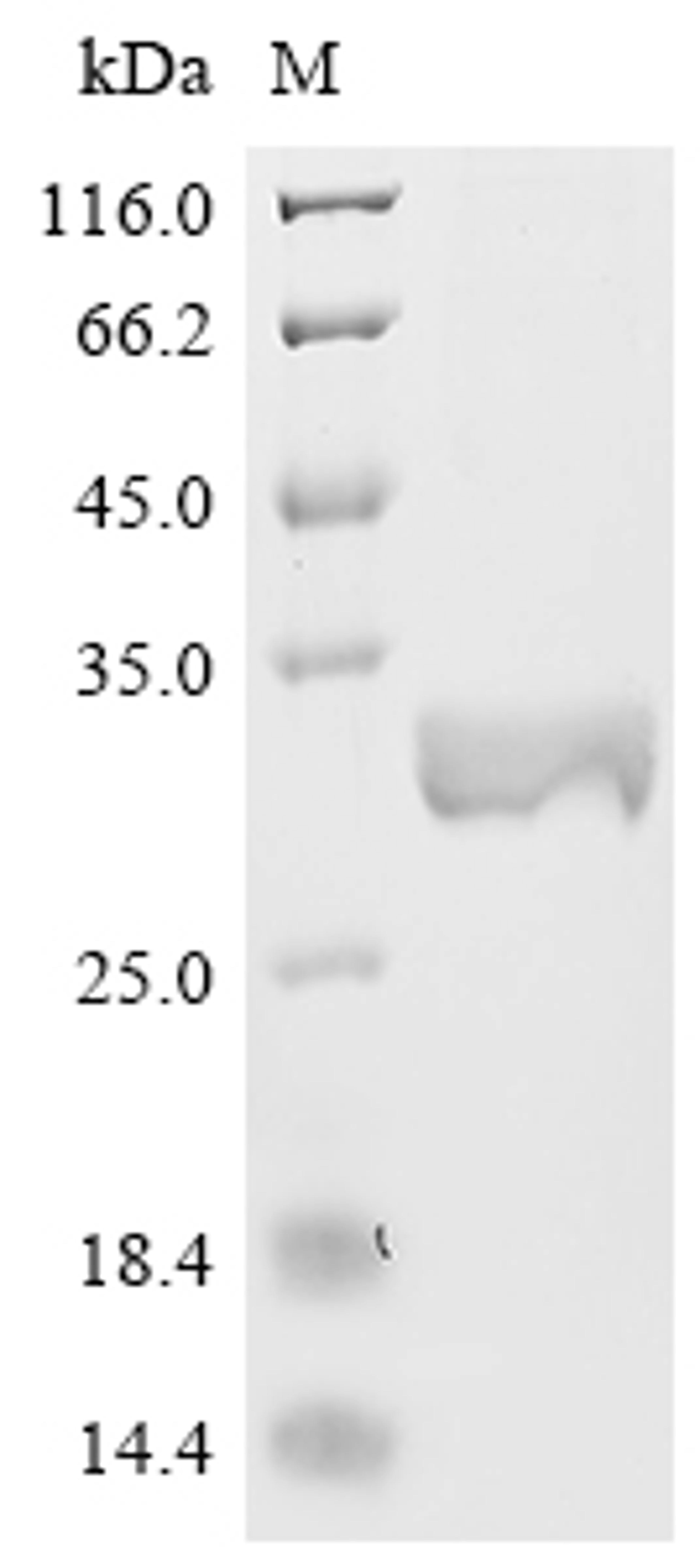 (Tris-Glycine gel) Discontinuous SDS-PAGE (reduced) with 5% enrichment gel and 15% separation gel.