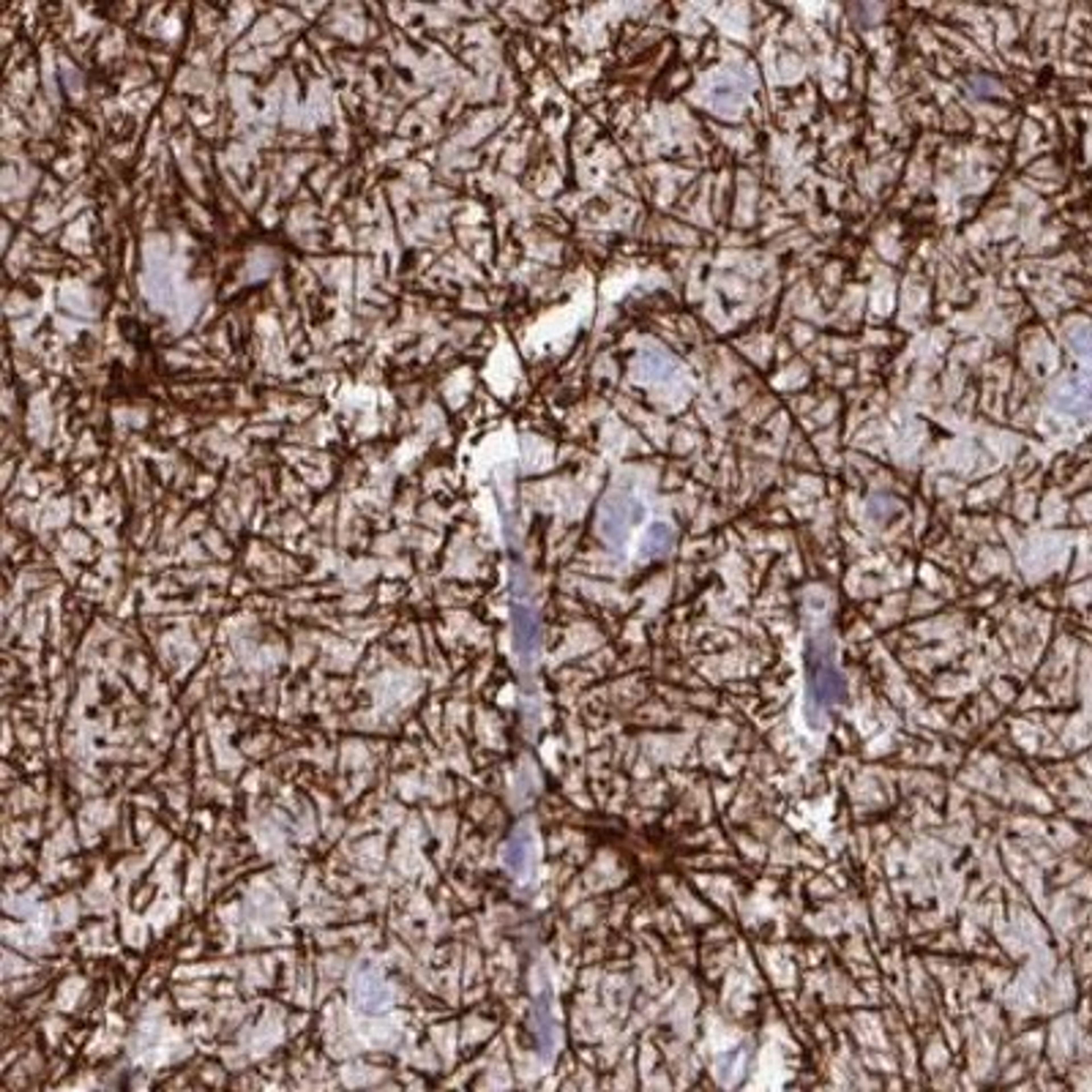 Western Blot: C17orf96 Antibody [NBP2-47535] - Analysis of hippocampus tissue.