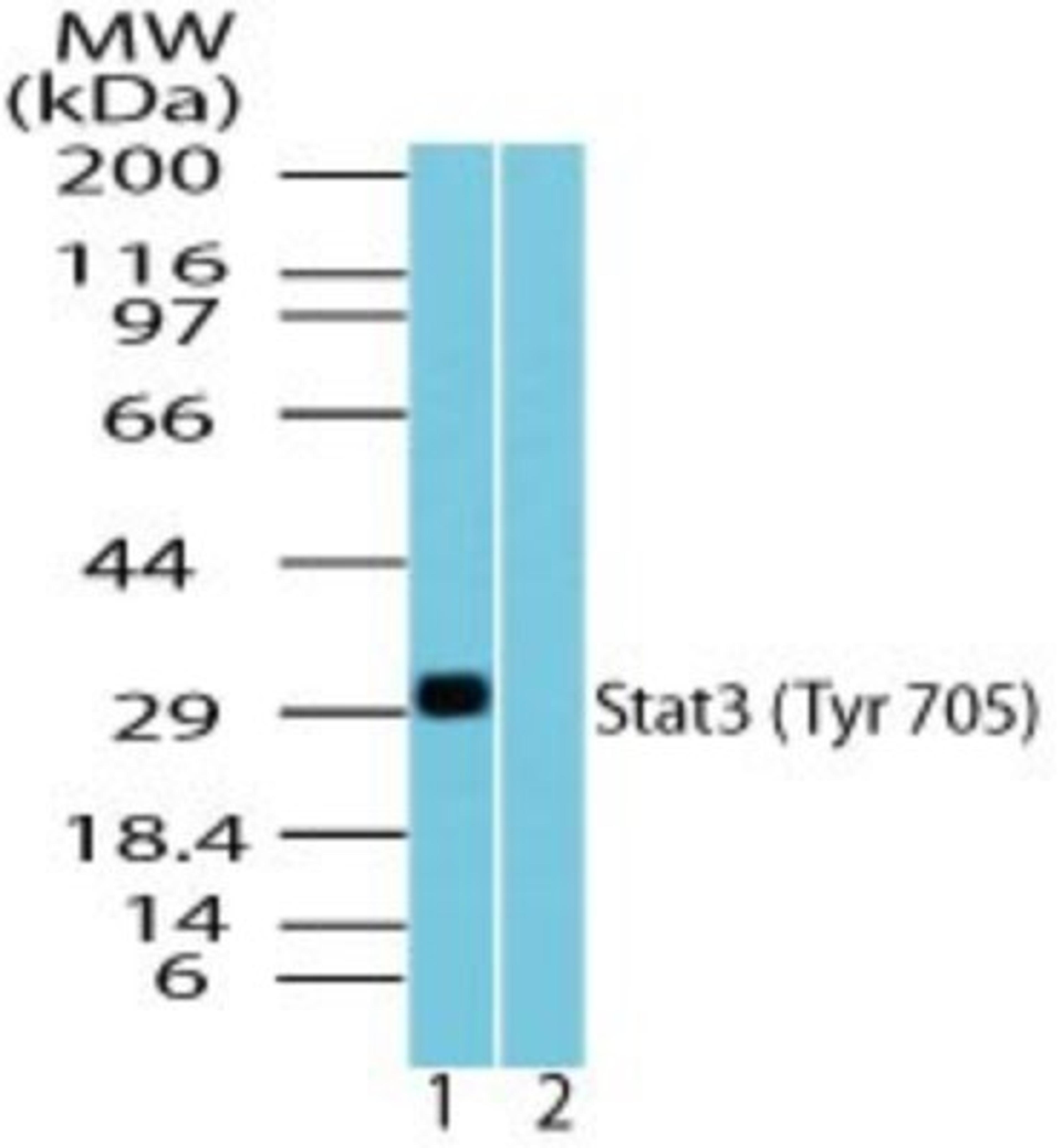 Western Blot: STAT3 [p Tyr705] Antibody [NBP2-24463] - Analysis of STAT3 (Tyr705) in recombinant fusion protein containing 1) a phosphorylated tyrosine at position 705 and 2) an unphosphorylated tyrosine at position 705, using STAT3 phospho antibody at 0.1 ug/ml. Goat anti-rabbit Ig HRP secondary antibody and PicoTect ECL substrate solution were used for this test.