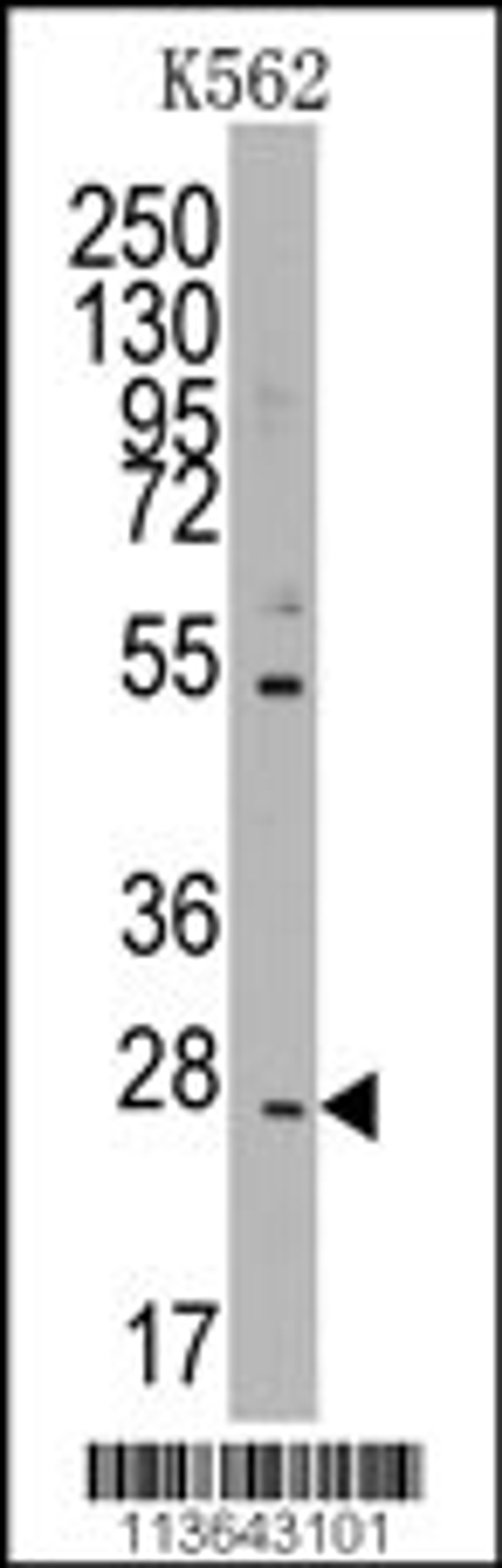 Western blot analysis of anti-CD8B1 Pab in K562 cell line lysates (35ug/lane).