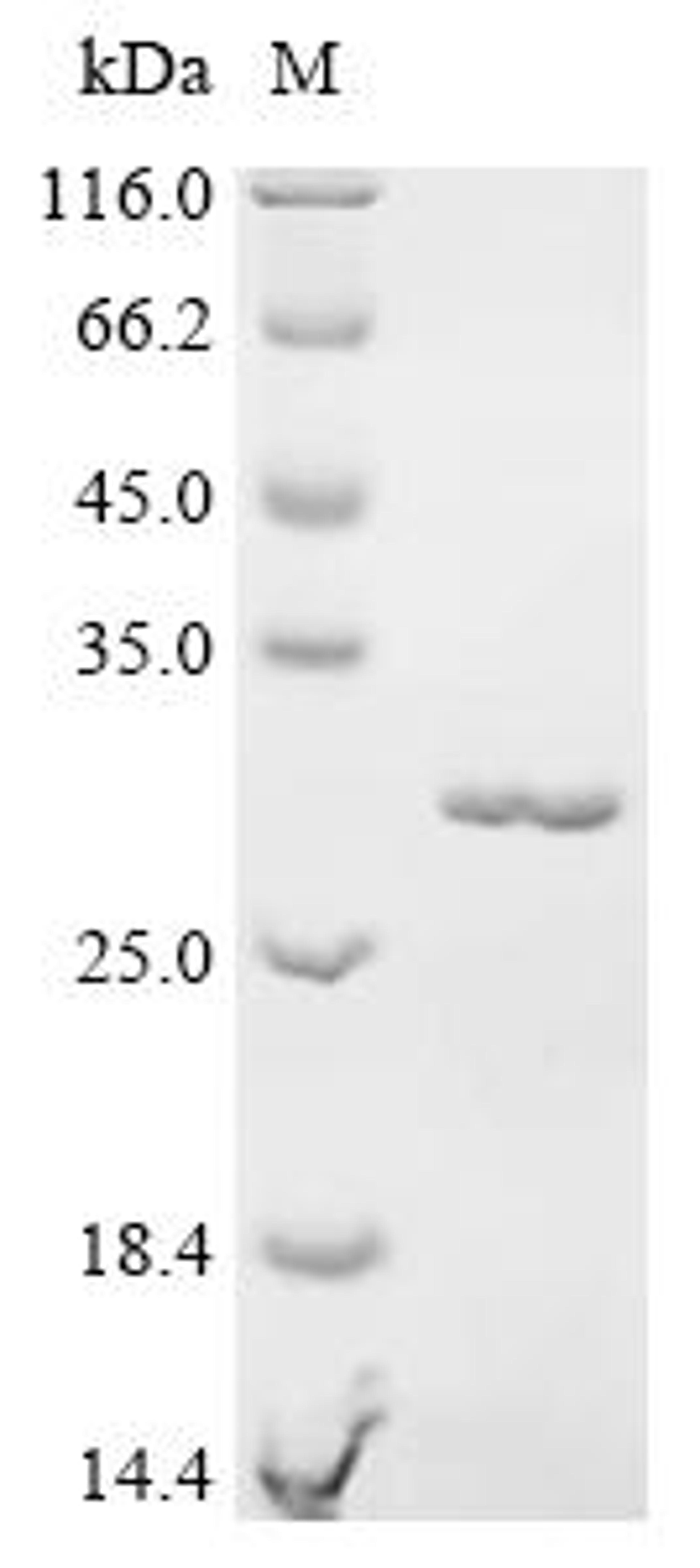 (Tris-Glycine gel) Discontinuous SDS-PAGE (reduced) with 5% enrichment gel and 15% separation gel.