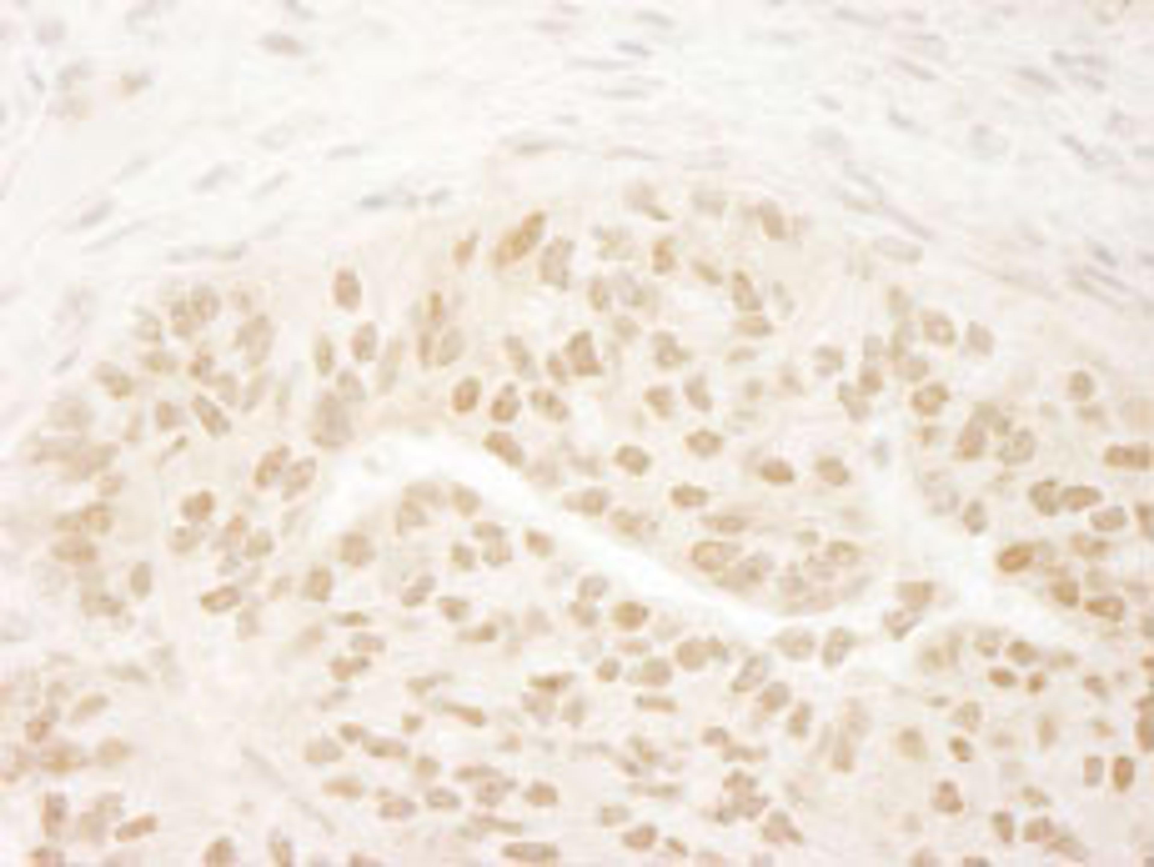 Detection of human DOT1L by immunohistochemistry.