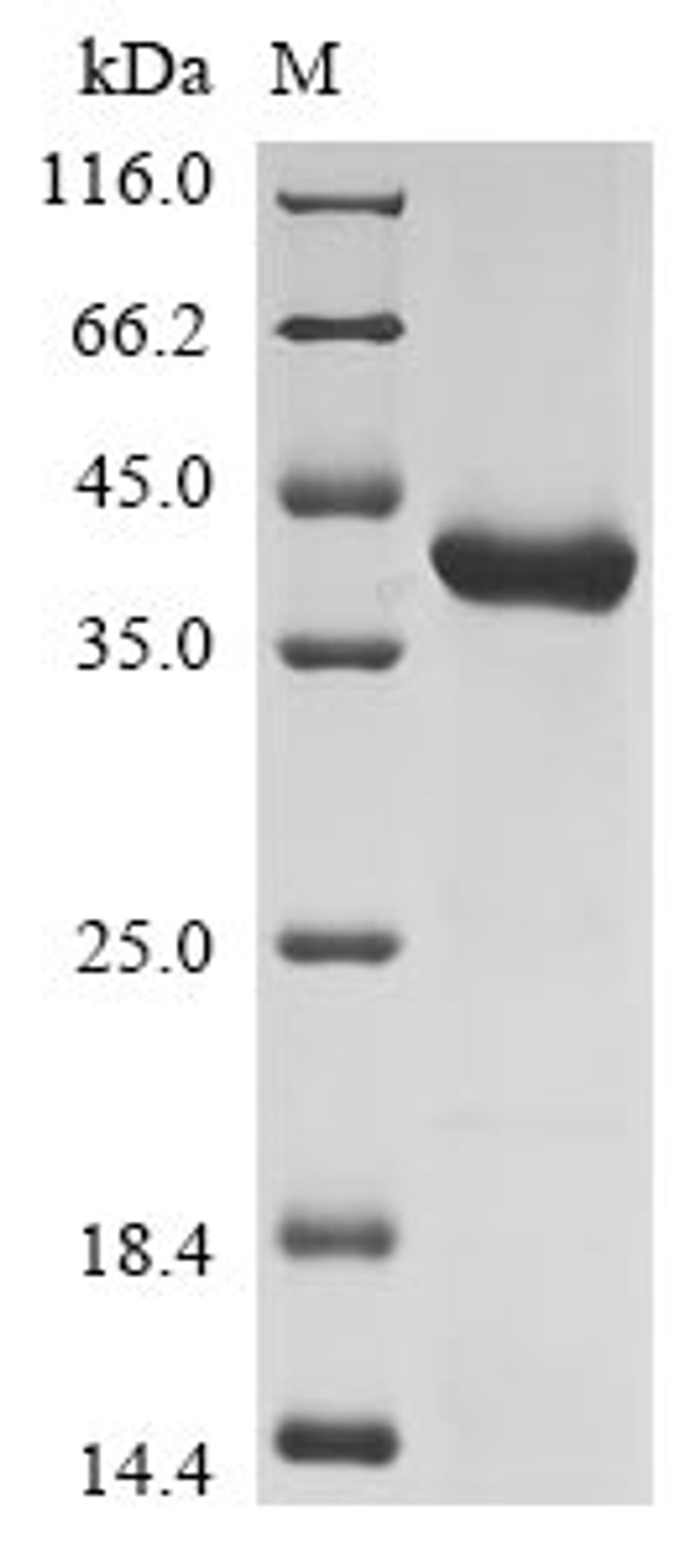 (Tris-Glycine gel) Discontinuous SDS-PAGE (reduced) with 5% enrichment gel and 15% separation gel.