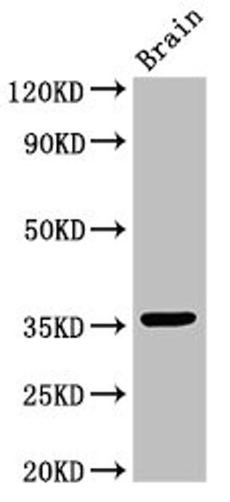 Western Blot. Positive WB detected in: Mouse brain tissue. All lanes: MNAT1 antibody at 3ug/ml. Secondary. Goat polyclonal to rabbit IgG at 1/50000 dilution. Predicted band size: 36, 32 kDa. Observed band size: 36 kDa.