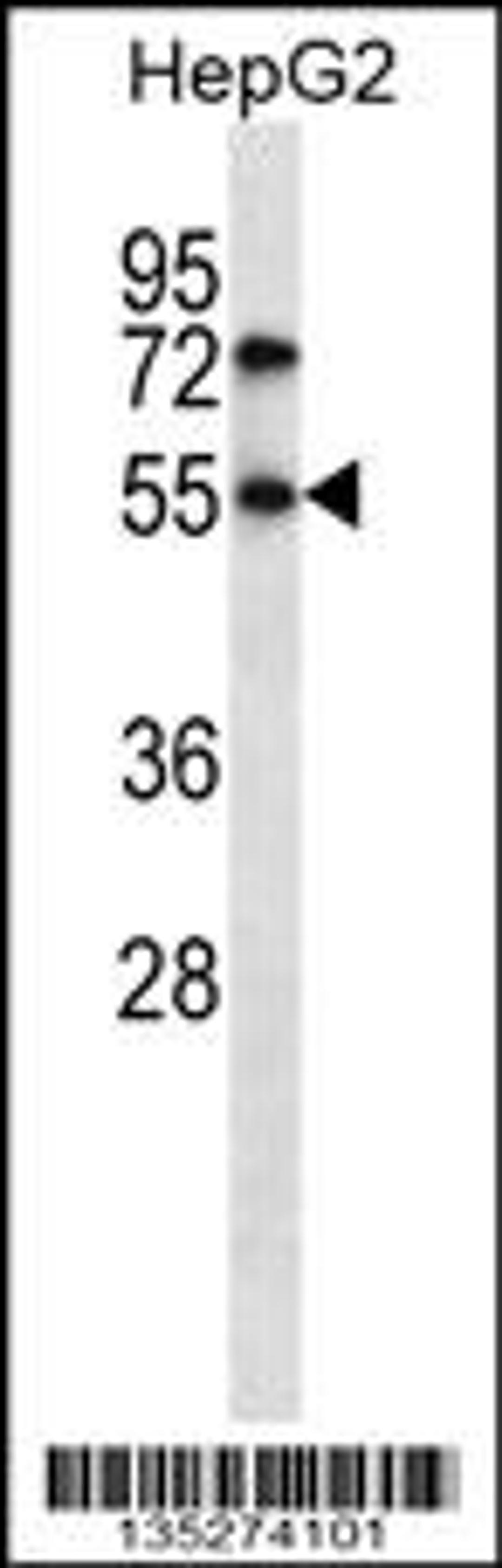 Western blot analysis in HepG2 cell line lysates (35ug/lane).