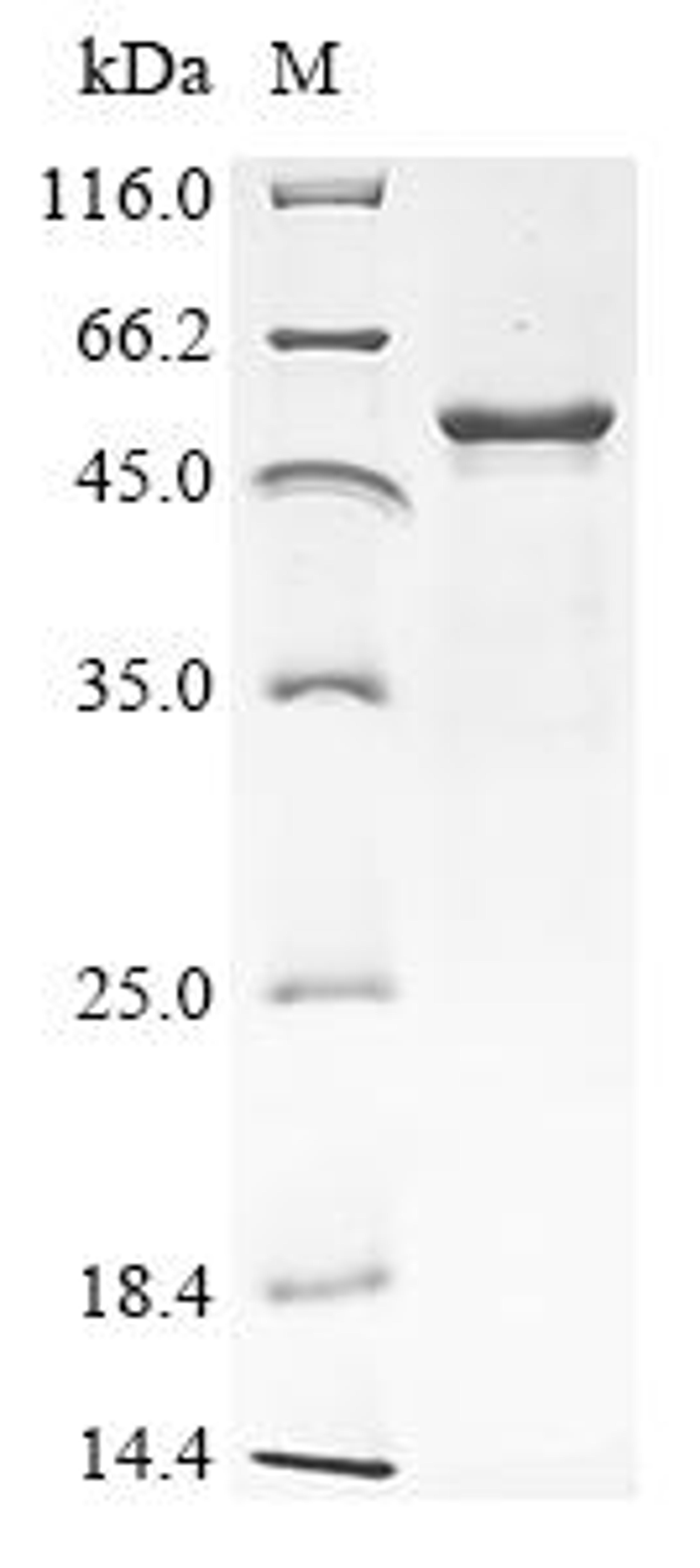 (Tris-Glycine gel) Discontinuous SDS-PAGE (reduced) with 5% enrichment gel and 15% separation gel.