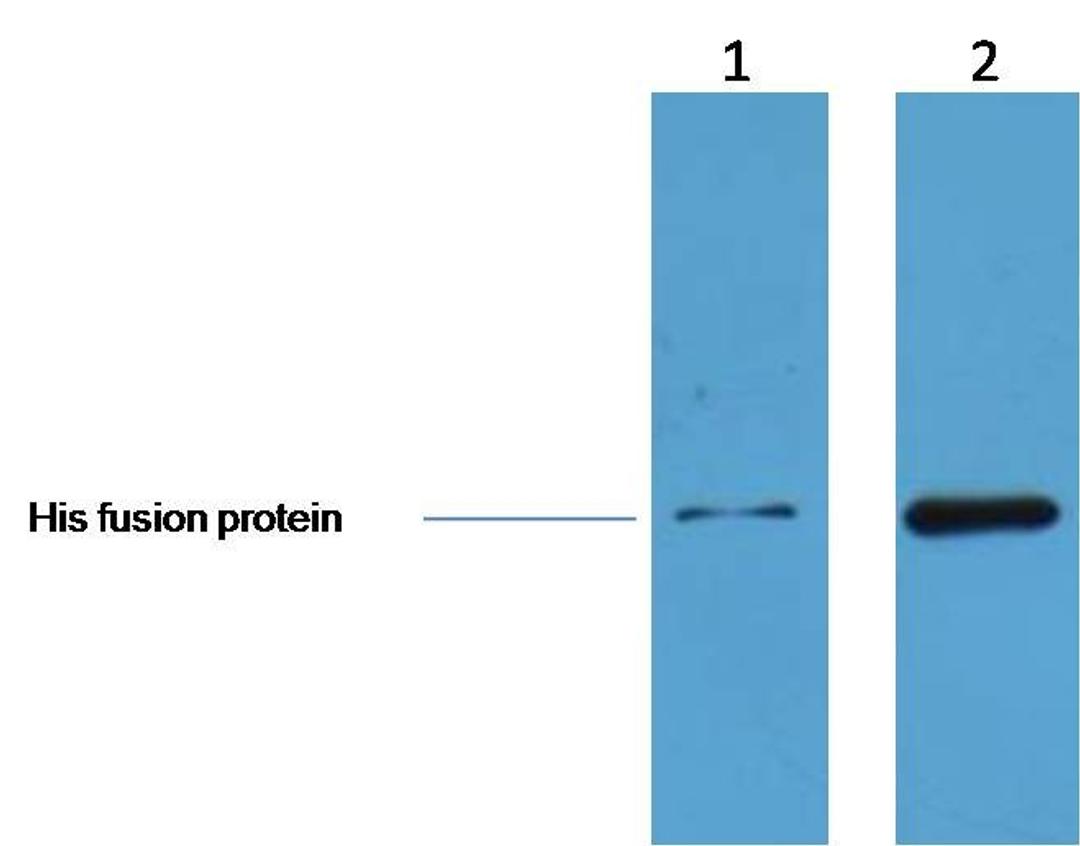 Western blot analysis of human cell line lysates using His-Tag Rabbit pAb antibody