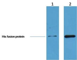 Western blot analysis of human cell line lysates using His-Tag Rabbit pAb antibody