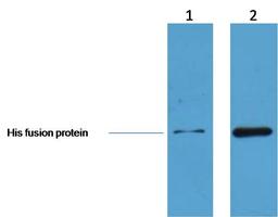 Western blot analysis of human cell line lysates using His-Tag Rabbit pAb antibody