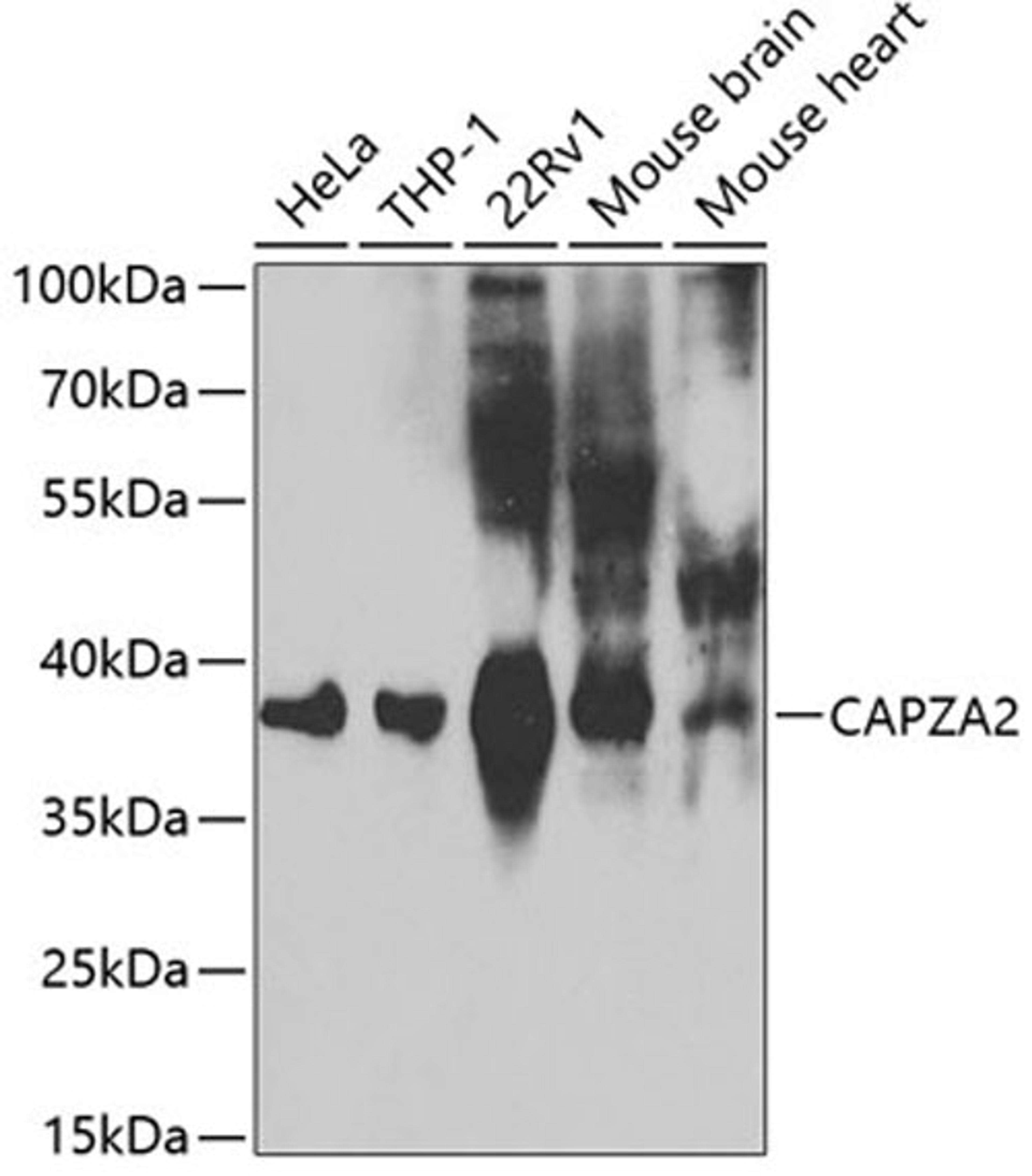 Western blot - CAPZA2 antibody (A2054)