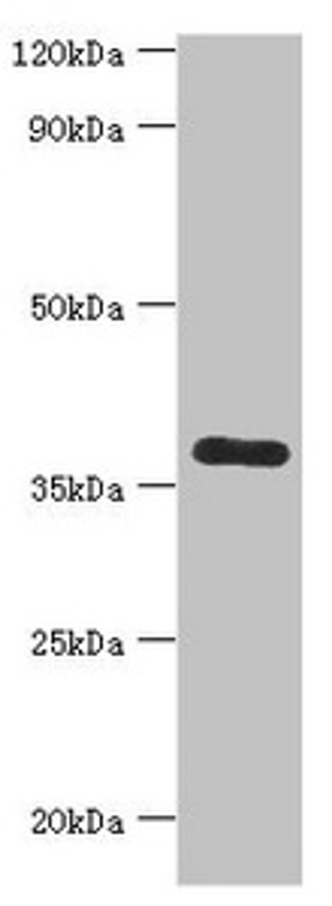 Western blot. All lanes: Calcium homeostasis modulator protein 1 antibody at 7ug/ml + Mouse liver tissue. Secondary. Goat polyclonal to rabbit IgG at 1/10000 dilution. Predicted band size: 38 kDa. Observed band size: 38 kDa.