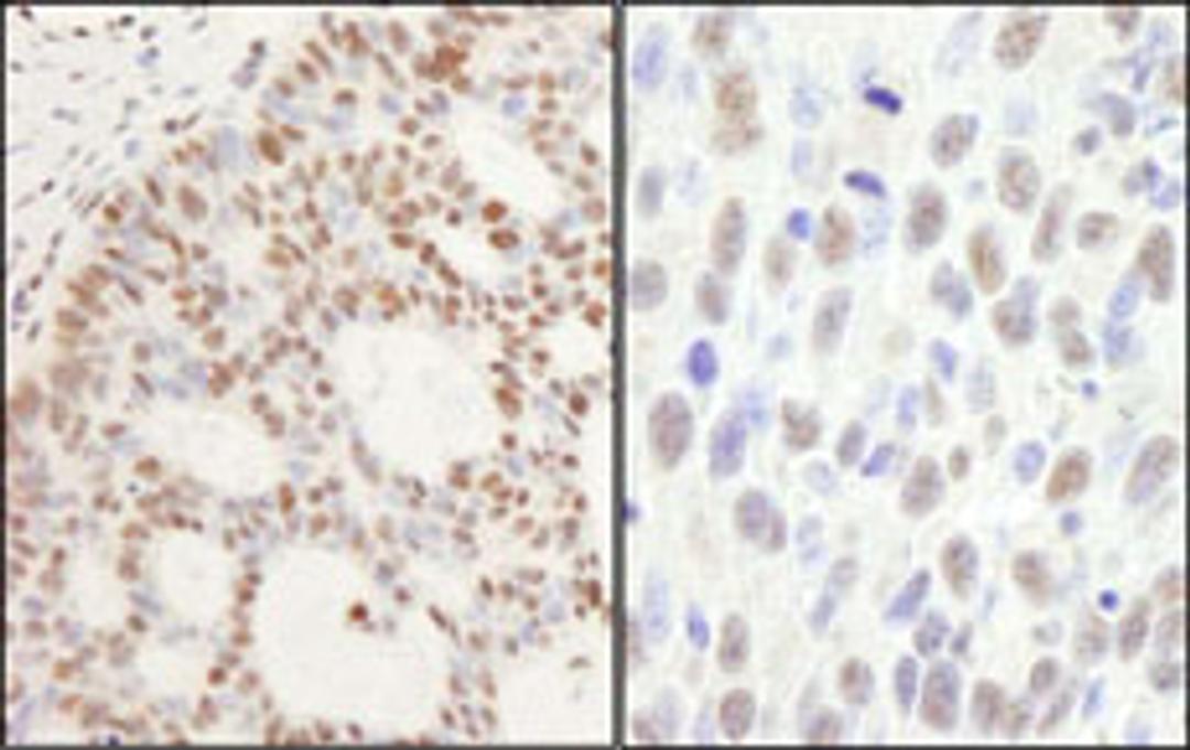 Detection of human and mouse PPM1G by immunohistochemistry.